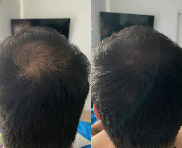 Hairline Repair Powder