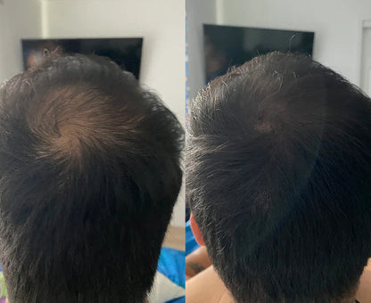 Hairline Repair Powder